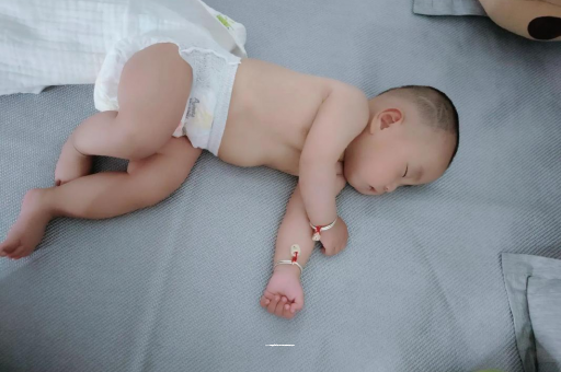 荣成六个月宝宝眼睛散光